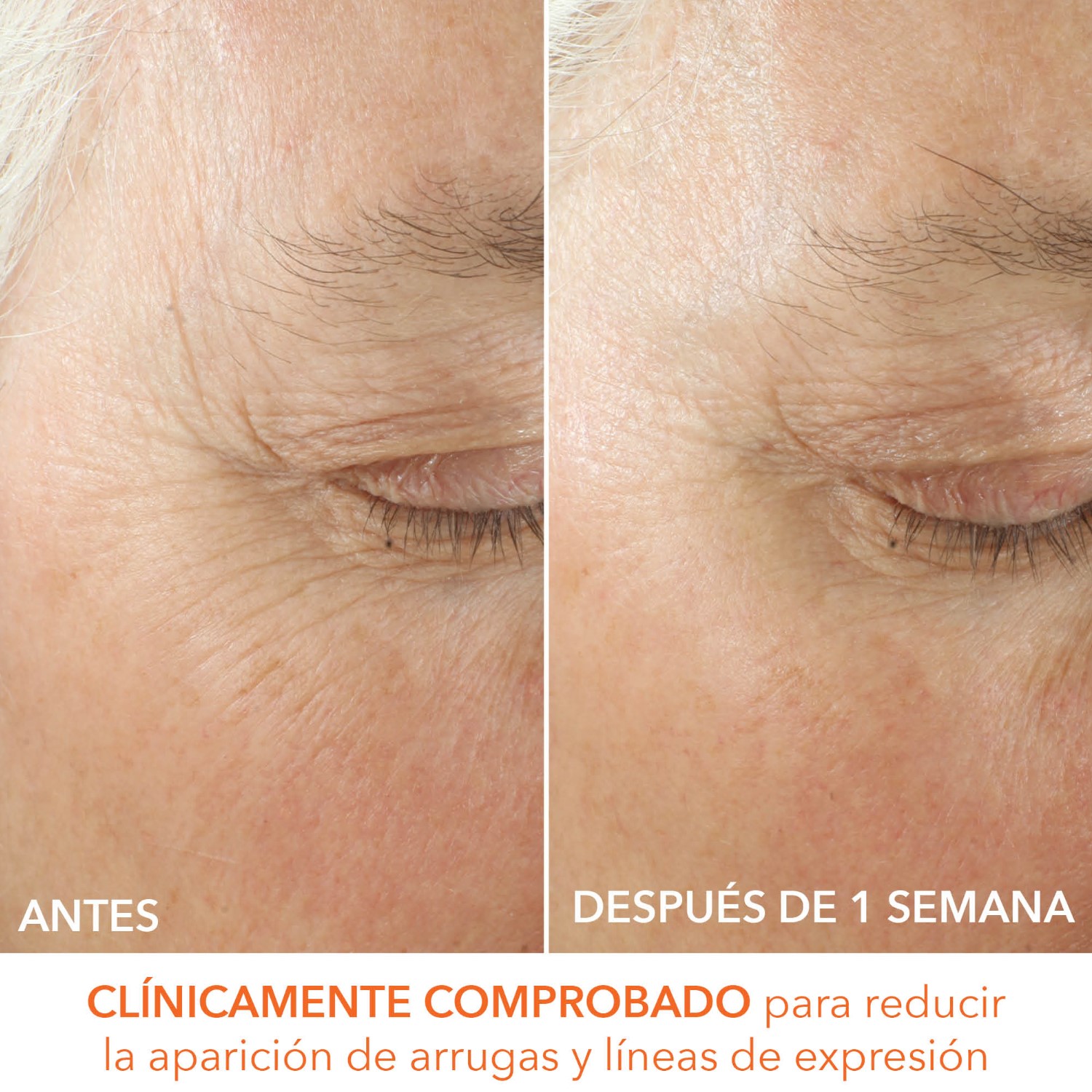 ALPHA BETA ULTRA GENTLE DAILY PEEL (ALMOHADILLAS EXFOLIANTES DIARIAS ULTRASUAVES PARA PIELES SENSIBLES)
